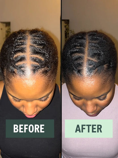 AUERLYX No.03 Peptide Hair Growth Serum