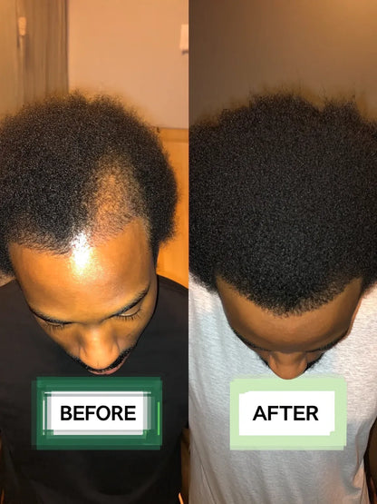AUERLYX No.02 — Scalp Renewal Oil (Shedding Support)