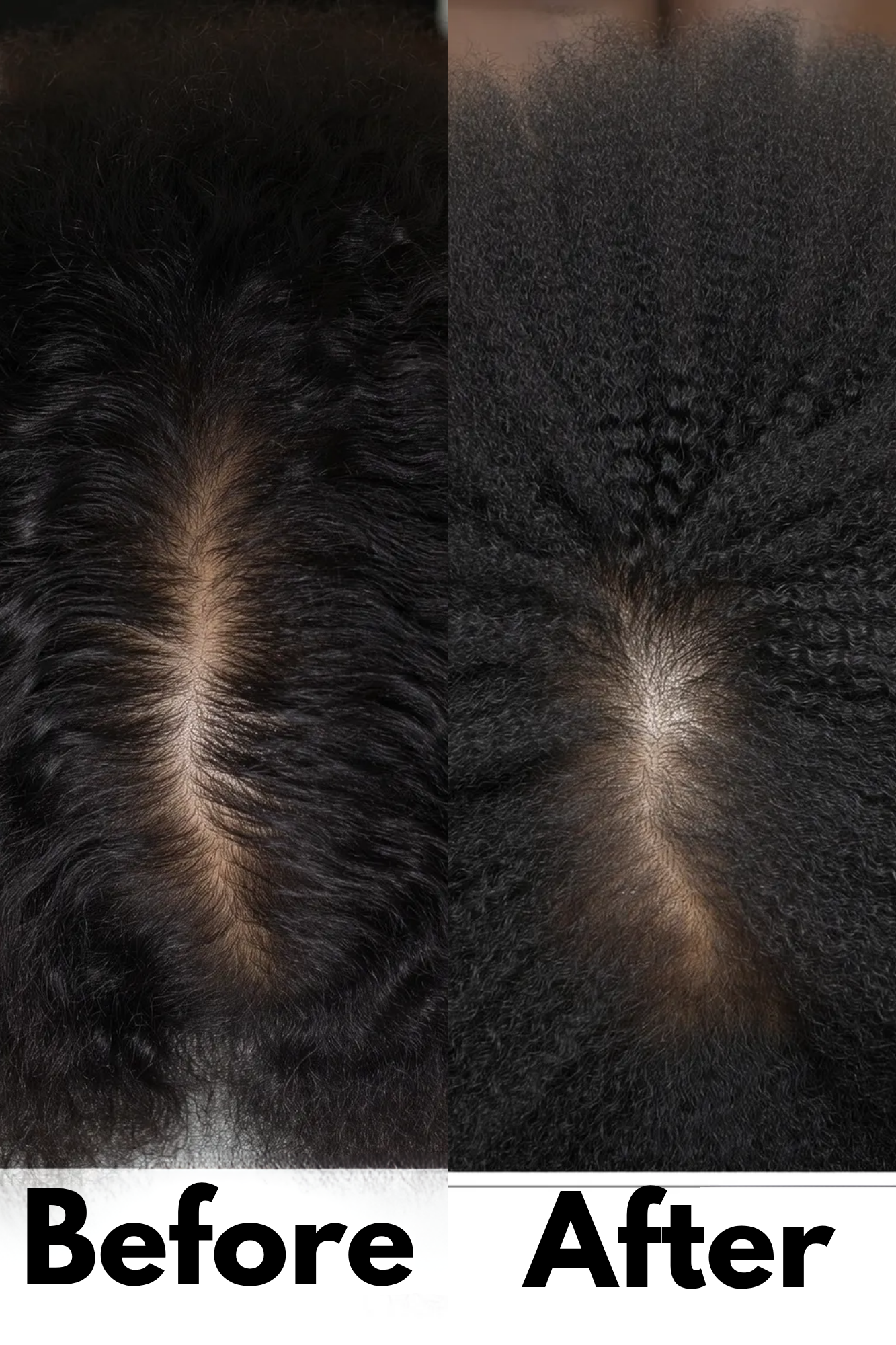 AUERLYX No.02 — Scalp Renewal Oil (Shedding Support)