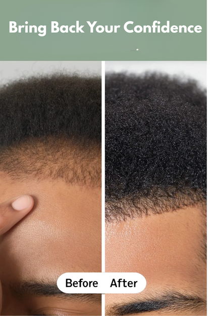 AUERLYX No.02 — Scalp Renewal Oil (Shedding Support)