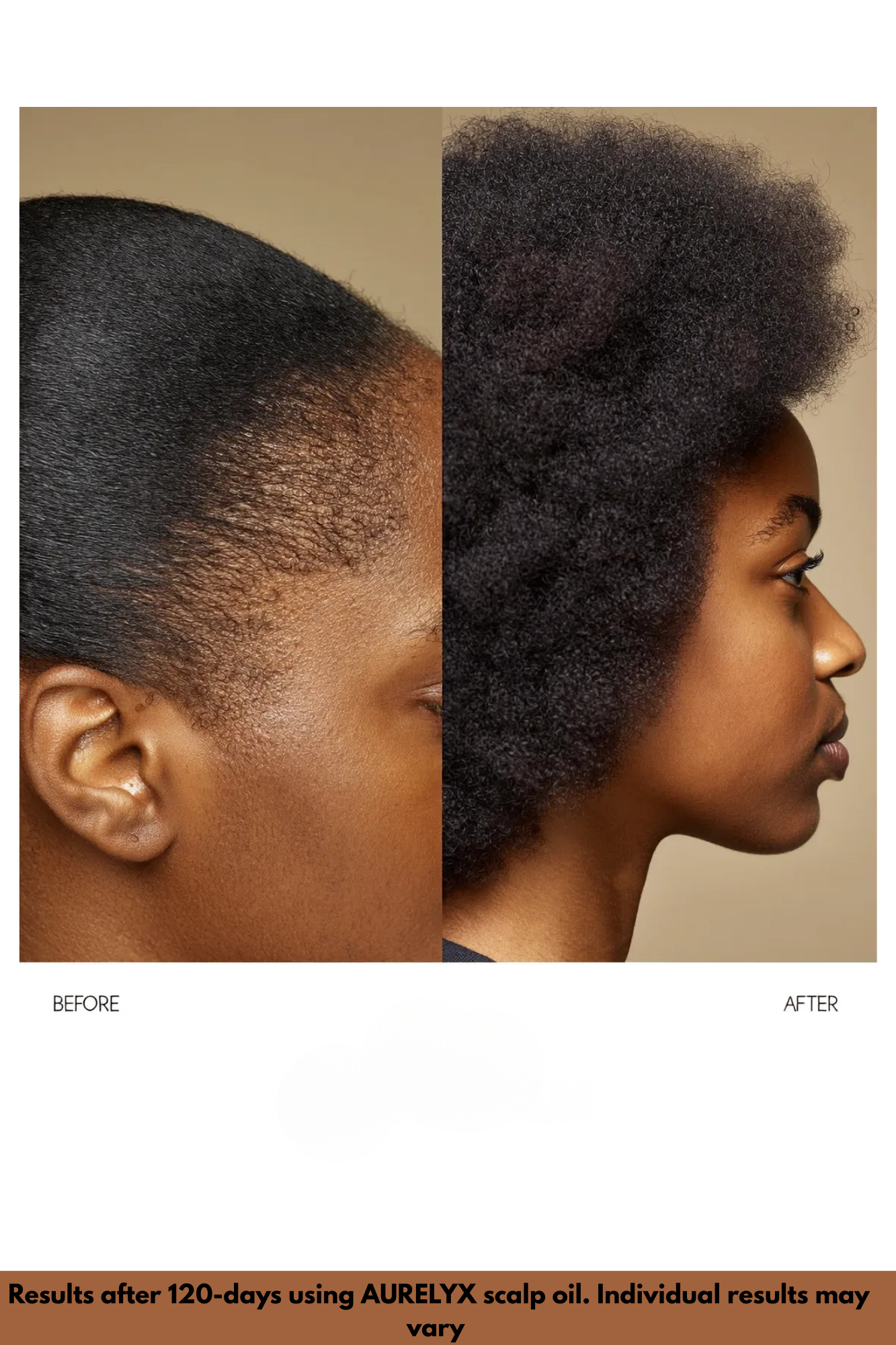 AUERLYX No.02 — Scalp Renewal Oil (Shedding Support)